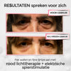 Lunéra™ | Red Light Oogverzorging